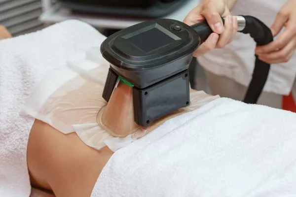 Image of person having fat freezing treatment to help weight gain Newbury