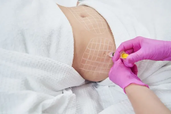 image of fat dissolving injections on love handles to help combat weight gain Newbury