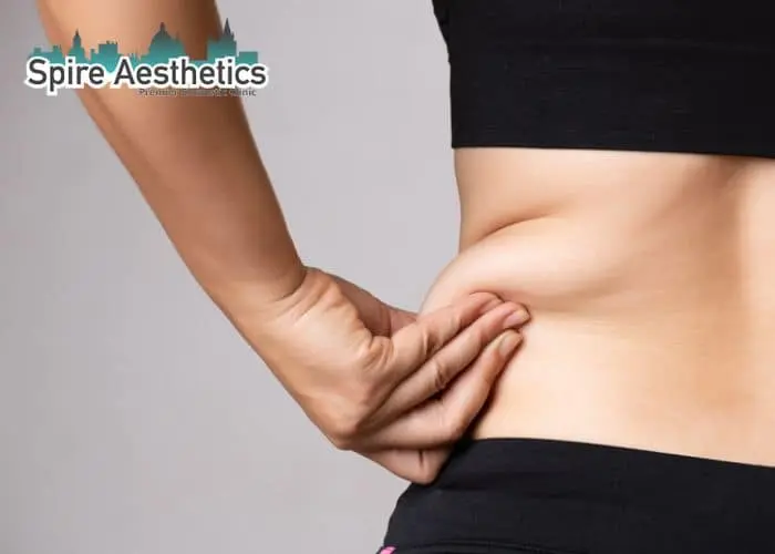 Image of woman pinching fat on their hips Newbury. Fat Freezing treatment