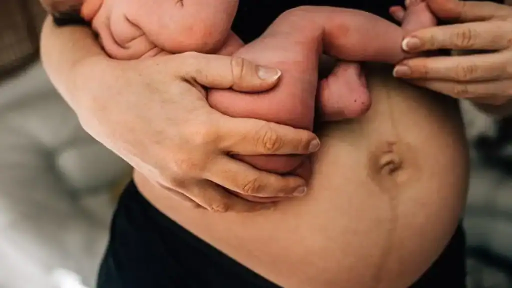 Why Is My Stomach Still Big After Pregnancy Newbury?